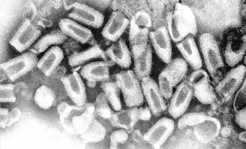 Theo kiến thức ý khoa hiện đại, bệnh dại do virus dại gây nên. Đây là một bệnh truyền nhiễm virus cấp tính của hệ thần kinh trung ương dẫn đến tử vong.