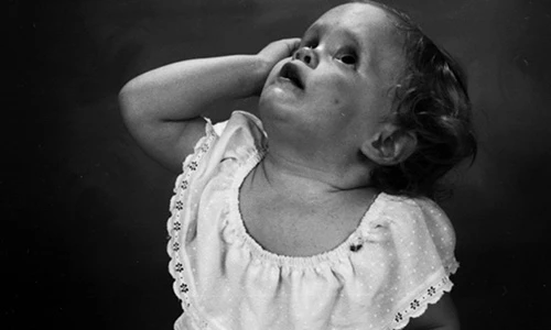 Xót lòng bộ ảnh cha chụp con gái tự kỷ suốt 30 năm