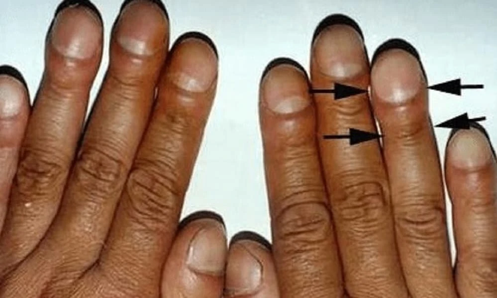 Cách chẩn đoán các bệnh nội tạng, đặc biệt là ung thư 