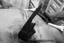 Cứu sống nam thanh niên bị gỗ đâm thấu ngực ở Quảng Bình