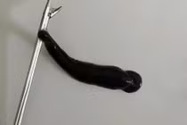 Gắp ra con đỉa sống ký sinh trong mũi bệnh nhi ở Quảng Trị