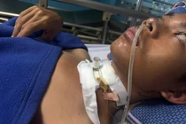 Cứu sống nam sinh bị đứt khí quản 
