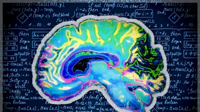 Não người thoái hóa sau nhiều ngày dùng ChatGPT