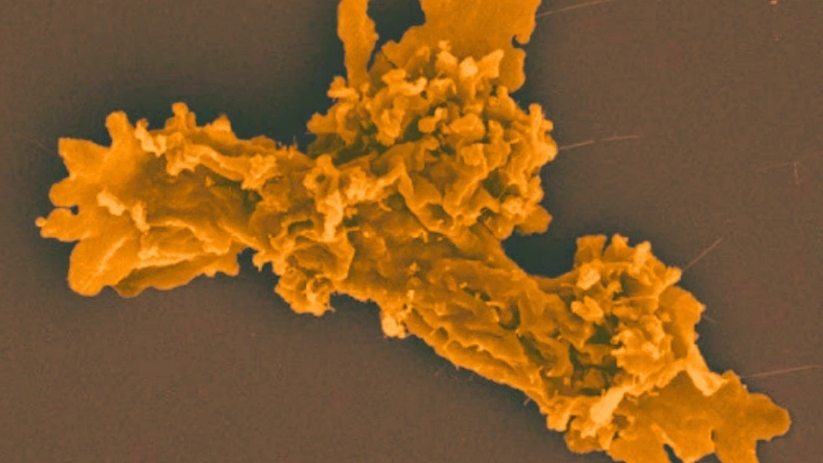 View - Bí ẩn sinh vật 'bất tử nhiệt', sức chịu nhiệt vượt ngưỡng sự sống | Báo Tri thức và Cuộc sống - TIN TỨC PHỔ BIẾN KIẾN THỨC 24H