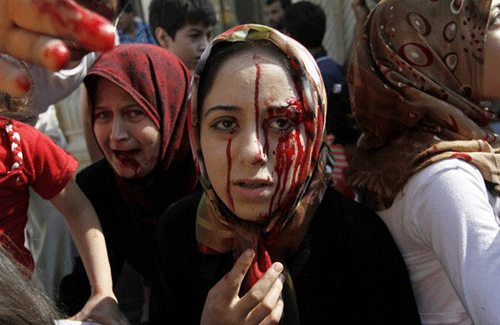Ngày 15/8 2012 – Những phụ nữ Syria bị thương tại một bệnh viện dã chiến sau một cuộc không kích trúng nhà của họ tại thị trấn Azaz ở ngoại ô Aleppo.