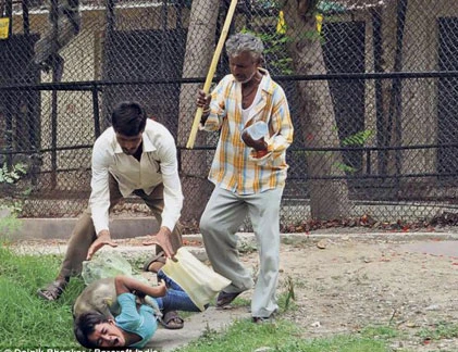 Kinh hoàng bé trai Ấn Độ bị khỉ cắn xé