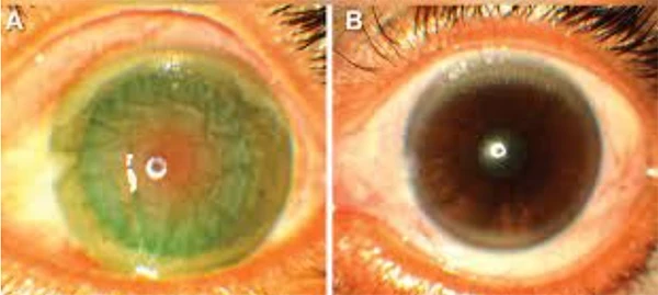 Vì sao rắn hổ mang phun nọc độc "bách phát bách trúng" vào mắt người?