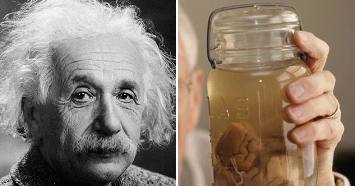 Bác sĩ “điên rồ” nào cả gan đánh cắp bộ não của thiên tài Einstein?