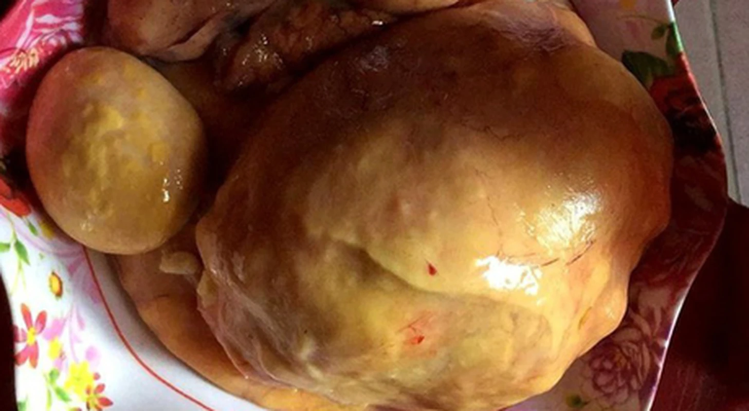 Phát hiện 25 "dị vật" trong bụng gà, nông dân lập tức đổi đời