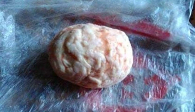 Bất ngờ phát hiện 'dị vật' gần 2 tỷ trong bụng lợn