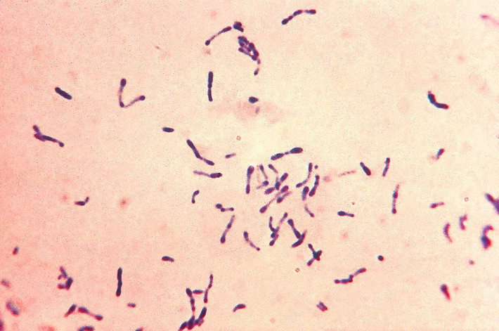 Corynebacterium diphtheriae là vi khuẩn gây ra bệnh bạch hầu. Vi khuẩn có thể xâm nhập vào hầu họng ở những cá thể nhạy cảm. Tại đây tiết ra độc tố có khả năng ức chế quá trình tổng hợp của tế bào do đó làm chết tế bào và hình thành các màng giả tại chỗ.