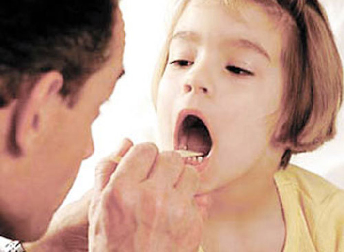 Ở giai đoạn đầu, bệnh bạch hầu thường khó phân biệt với các bệnh lý viêm mũi họng cấp khác trên lâm sàng. Bệnh thường sẽ phát hiện được một màng trắng ở vách ngăn mũi nếu thăm khám cẩn thận.