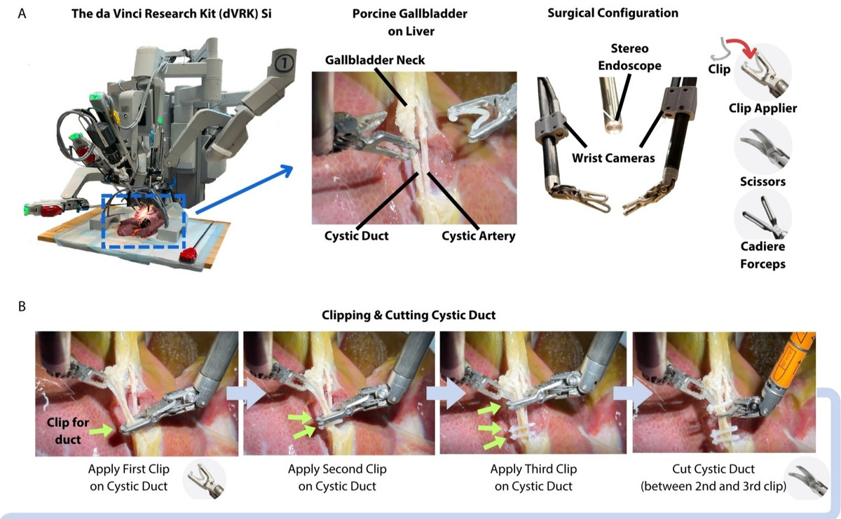 Điều đặc biệt ở SRT-H là khả năng vượt ra ngoài những giới hạn của các robot phẫu thuật truyền thống, không chỉ thực hiện các tác vụ được lập trình sẵn mà còn có thể phản ứng và học hỏi trong thời gian thực.