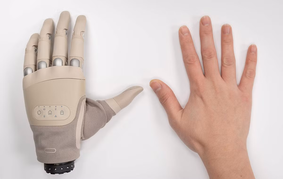 Marshall Trout, nghiên cứu sinh sau tiến sĩ tại Phòng thí nghiệm Thần kinh Robot thuộc Đại học Utah, chia sẻ về thực trạng này: "Mặc dù các cánh tay sinh học đang ngày càng trở nên giống thật, việc điều khiển chúng vẫn chưa dễ dàng hay trực quan. Gần một nửa số người dùng sẽ từ bỏ chi giả của họ, thường với lý do là khả năng điều khiển kém và gánh nặng nhận thức".