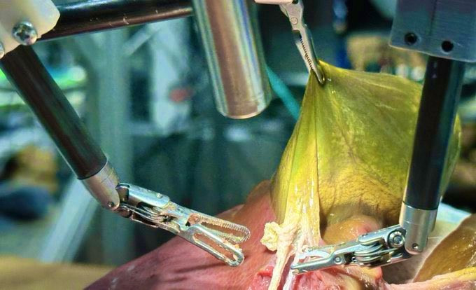 Theo nhận xét của chuyên gia robot y tế Axel Krieger, người dẫn đầu nghiên cứu, sự chuyển đổi từ việc thực hiện các tác vụ riêng lẻ sang thực sự hiểu biết các quy trình phẫu thuật là bước tiến then chốt. Ông so sánh robot này với xe tự lái có thể "di chuyển trên bất kỳ con đường nào, trong bất kỳ điều kiện nào, phản ứng thông minh với mọi thứ gặp phải".