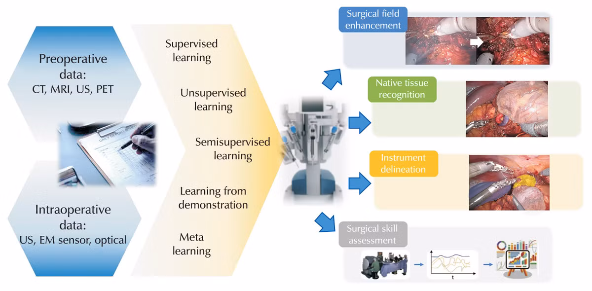 So với các robot phẫu thuật hiện có như hệ thống da Vinci của Intuitive Surgical, vốn đã được FDA phê duyệt từ năm 2000 và sử dụng trong hơn 12 triệu ca phẫu thuật trên toàn cầu - SRT-H đại diện cho một bước nhảy vọt về công nghệ. Trong khi hệ thống da Vinci hoàn toàn phụ thuộc vào bác sĩ phẫu thuật để điều khiển từ xa, SRT-H có thể hoạt động hoàn toàn độc lập.
