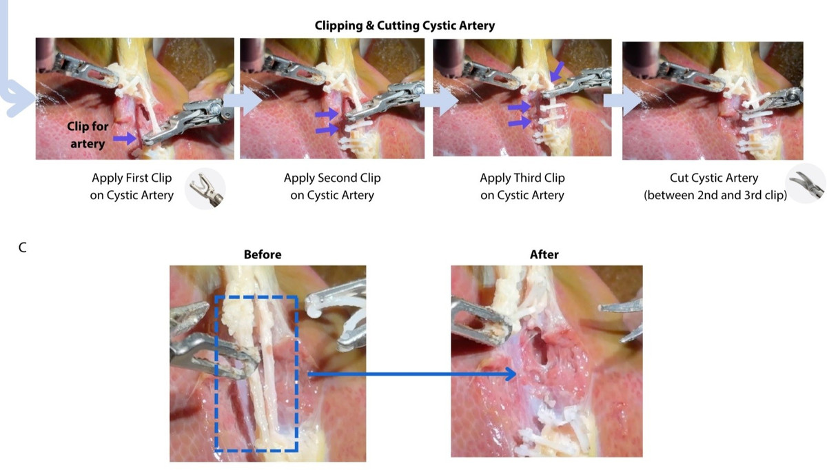 Công nghệ cốt lõi của SRT-H dựa trên kiến trúc máy học tiên tiến, tương tự như công nghệ được sử dụng trong các hệ thống AI như ChatGPT. Điều này cho phép robot xử lý các lệnh bằng giọng nói từ đội ngũ y tế và điều chỉnh hành động dựa trên phản hồi thời gian thực. Khả năng thích ứng này cực kỳ quan trọng trong việc giải quyết những thách thức bất ngờ có thể xảy ra trong quá trình phẫu thuật.