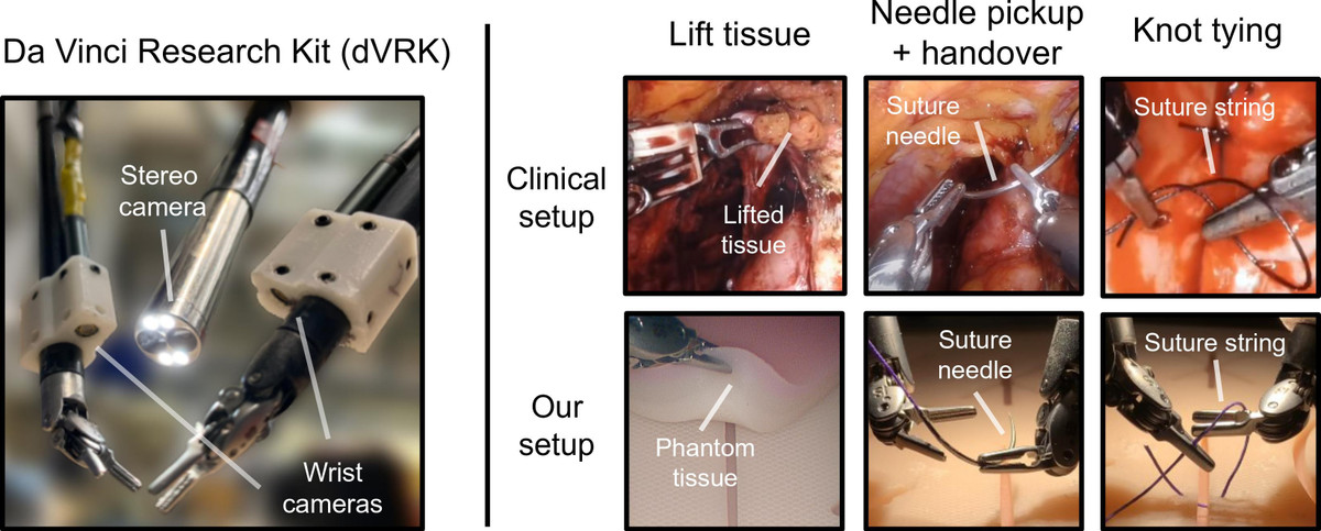 Ji Woong "Brian" Kim, một nhân vật quan trọng trong việc phát triển SRT-H, nhấn mạnh rằng độ tin cậy của các mô hình AI cho việc tự động hóa phẫu thuật giờ đây đã có thể chứng minh được. Tiến bộ này mở ra những khả năng mới trong việc nâng cao độ chính xác và an toàn phẫu thuật, có tiềm năng cách mạng hóa việc chăm sóc bệnh nhân bằng cách giảm thiểu sai sót của con người và cải thiện kết quả điều trị.