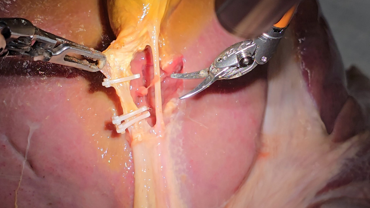 Trong các thử nghiệm, SRT-H đã được kiểm tra trên tám bộ túi mật và gan heo với cấu tạo giải phẫu đa dạng, phản ánh sự khác biệt thường gặp trong phẫu thuật trên người. Việc tách túi mật khỏi gan là một quy trình mất vài phút và đòi hỏi việc sử dụng đa dạng các công cụ, bao gồm kẹp, cắt và các kỹ năng ra quyết định cũng như thích ứng - những kỹ năng phổ biến trong các thủ thuật phẫu thuật thực tế.