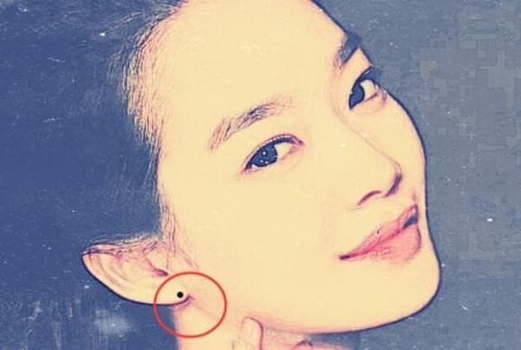 Nếu có nốt ruồi ở tai kiểu này thì chứng tỏ người này có tấm lòng nhân hậu, hay giúp đỡ người khác, sinh ra đã có phúc, thường gặp may mắn, tài lộc tự nhiên sẽ thịnh vượng. Bạn sẽ từng bước thăng tiến trong sự nghiệp và cuối cùng đạt được sự giàu có và vinh quang.