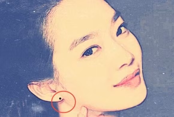 Nếu có nốt ruồi ở tai kiểu này thì chứng tỏ người này có tấm lòng nhân hậu, hay giúp đỡ người khác, sinh ra đã có phúc, thường gặp may mắn, tài lộc tự nhiên sẽ thịnh vượng. Bạn sẽ từng bước thăng tiến trong sự nghiệp và cuối cùng đạt được sự giàu có và vinh quang.