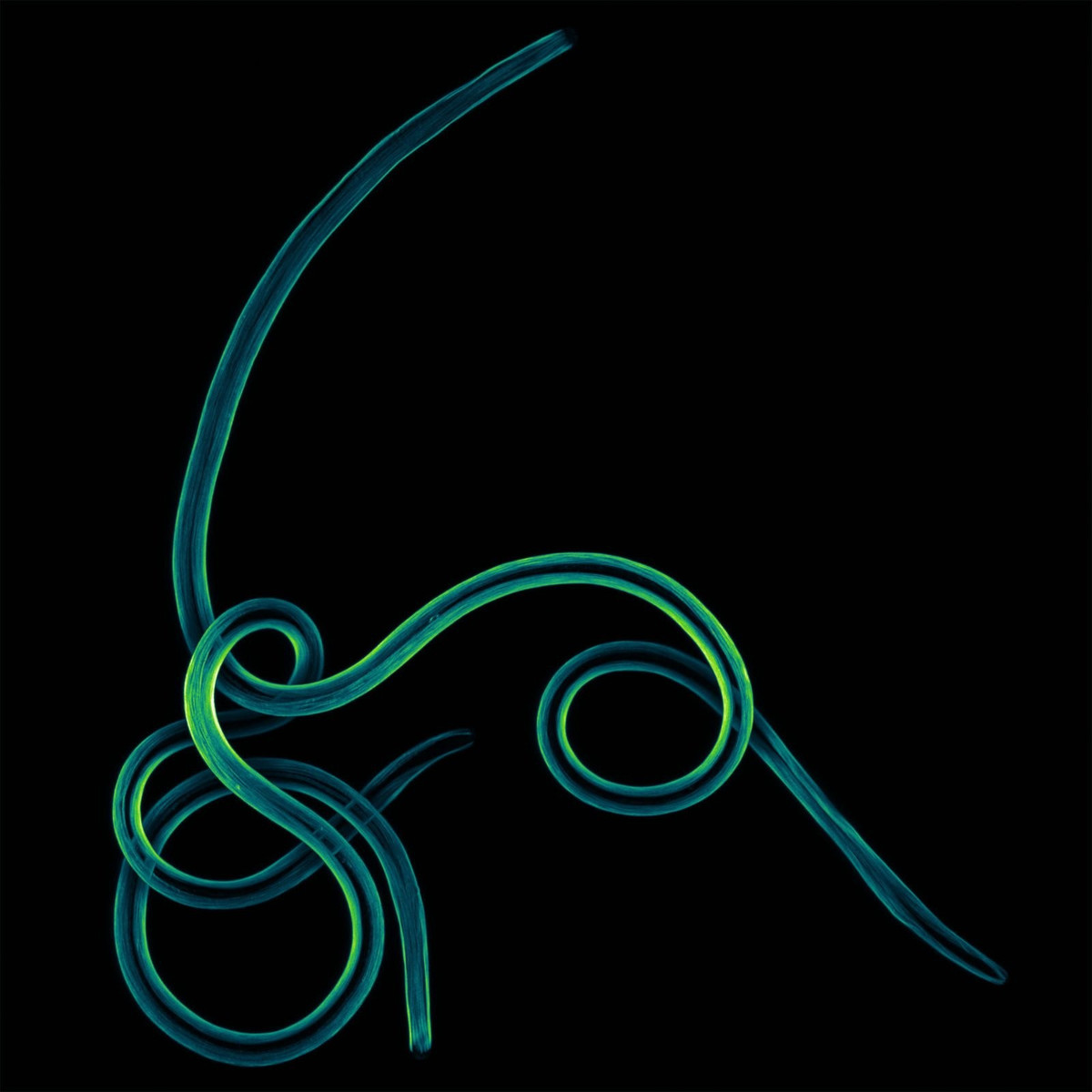 Bệnh giun chỉ là một loại nhiễm trùng ký sinh trùng gây ra bởi mẫu vật trong hình, một loại giun tròn ký sinh. Căn bệnh nhiệt đới này gây ra các vết phát ban đau đớn, rối loạn chức năng tế bào và thậm chí mù lòa. Tuy nhiên, nhìn gần thì nó trông chẳng hề đáng sợ chút nào.