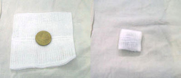 Nếu con bị rốn lồi, nên lấy đồng xu (loại 2.000 đồng), hoặc một miếng nhựa tròn có độ lớn tương tự, gói lại bằng băng gạc sạch, để lên lỗ rốn. Dùng băng thun rốn (có đàn hồi) quấn xung quanh bụng bé.