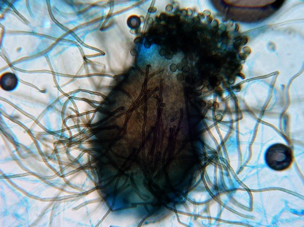 Chaetomium sp là một loại nấm mốc khá phổ biến trong cuộc sống hàng ngày, chúng thường trôi nổi trong không khí, đặc biệt là tại các khu vực ẩm ướt, đầm nước hay cả nhà tắm của bạn.