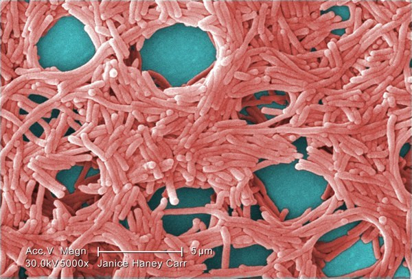 Vi khuẩn Legionella rất phổ biến ở các hồ tự nhiên, bùn và đất ẩm nhưng không gây hại cho con người. Việc nhiễm khuẩn Legionella chỉ xảy ra khi hít hoặc nuốt phải những giọt nước nhỏ có chứa Legionella.
