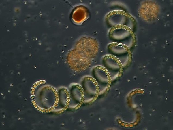 Anabaena sp hay còn gọi là vi khuẩn lam, môi trường sống của chúng hầu hết là các hồ nước ngọt lớn trên thế giới, đặc biệt là châu Úc, châu Âu, châu Á...Loại vi khuẩn này giống như một loại chất độc thần kinh ở thể gây ngừng hô hấp, may mắn thay, chúng ta có thể dễ dàng loại bỏ nó khỏi nước uồng bằng phương pháp lọc.