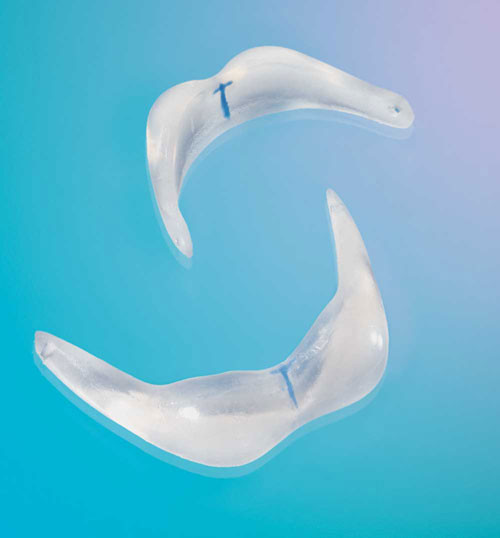 Miếng silicon - hay còn gọi là vật dụng độn cằm sẽ được cấy vào bên trong cằm để tạo hình khuôn mặt V-line