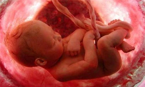 Một số bệnh lý khiến trẻ khó bú mẹ, ít nhất là trong giai đoạn đầu sau khi sinh (sứt môi hở hàm ếch, các bệnh lý thần kinh, tim mạch, hội chứng Down…được chẩn đoán trước sinh): Những trẻ này thường bú kém nên mẹ phải vắt sữa cho con; dự trữ sữa non trước sinh bổ sung nguồn cung cấp sữa nếu cần và giúp mẹ tập dượt vắt sữa trước khi bé chào đời.