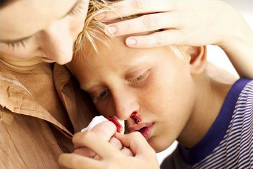 Chấn thương ở mũi: do tai nạn hay do va đập mạnh, đánh nhau. Khi bị tác dụng lực vào mũi, sẽ làm vỡ các mạch máu trong hốc mũi gây chảy máu và nếu nặng có thể gây mất máu với số lượng lớn, ảnh hưởng đến sức khỏe của trẻ.