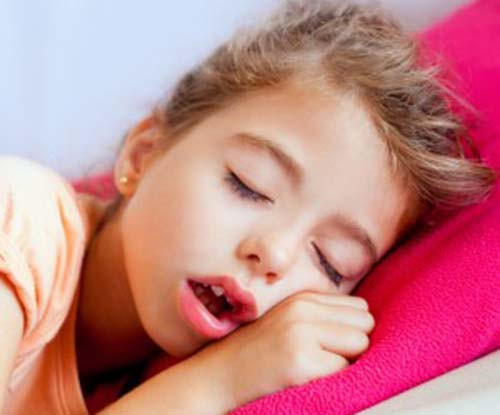 Thói quen bằng thở miệng. Thường gặp nhất ở trẻ có bệnh về mũi, dị ứng mũi, khiến cho trẻ khó thở mũi và tạo nên thói quen thở miệng. Ban đêm trẻ nằm ngủ cũng thở miệng. Thở miệng sẽ làm cho hàm răng trên phát triển về phía trước, hàm răng sẽ bị hô , cung răng hàm trên sẽ nhọn hơn, vẫu ra , khớp cắn sâu và cắn hở, nhóm răng cửa sẽ không cắn khít được.