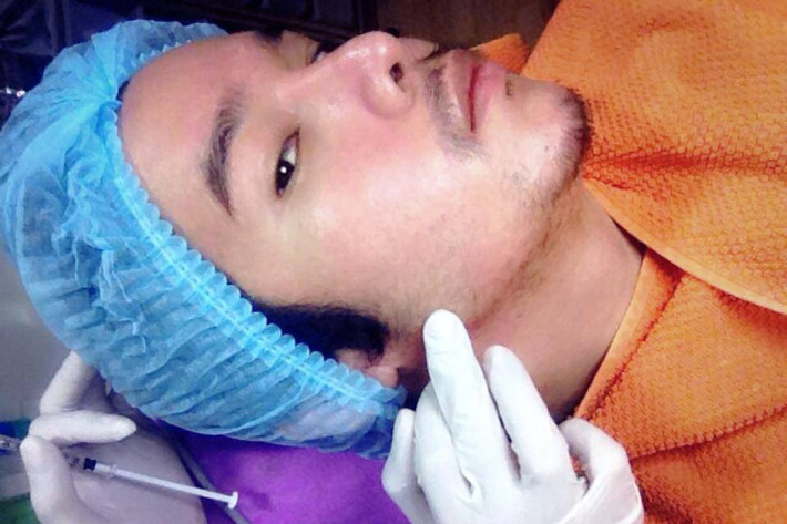 Chàng trai này đang tiến hành tiêm botox làm căng da mặt.