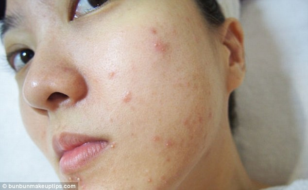 Ngày thứ 1: Gương mặt của Juli vài phút sau khi rửa mặt và dưỡng mặt. Dường như da của Juli đã có 1 vài phản ứng nhẹ, tuy nhiên cô vẫn tự tin để ra ngoài với gương mặt xinh đẹp của mình.