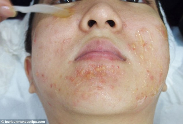 Nhìn thấy gương mặt của Juli, một bác sĩ của salon chỉ đơn giản nói cô có làn da quá nhạy cảm. Nếu chọc mủ nơi có những nốt mụn thì mọi thứ sẽ trở lại như cũ.