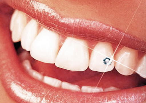 Nếu kỹ thuật khoan răng đính đá không đảm bảo sẽ khiến răng có thể bị ê buốt. Việc gắn đá lên răng cũng sẽ làm thay đổi cấu trúc răng. Khi đá bị bong ra lỗ răng bị khoan phải được hàn lại. Sau khi gắn đá vào răng khiến cho nhiều người gặp khó khăn trong sinh hoạt, thức ăn nhiều khi bám xung quanh đá làm răng rất dễ bị sâu.