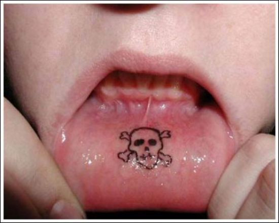 Biểu tượng của sự chết chóc.