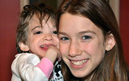 Brooke Greenberg, Mỹ là một thiếu nữ 17 tuổi nhưng không phát triển về thể chất lẫn tinh thần. Cô bé chỉ cao khoảng 76cm và đầu óc chỉ như đứa bé 1 tuổi