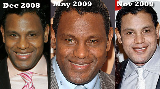 Sammy Sosa, một nam vận động viên bóng chày cũng đã đổ tiền vào tắm trắng.