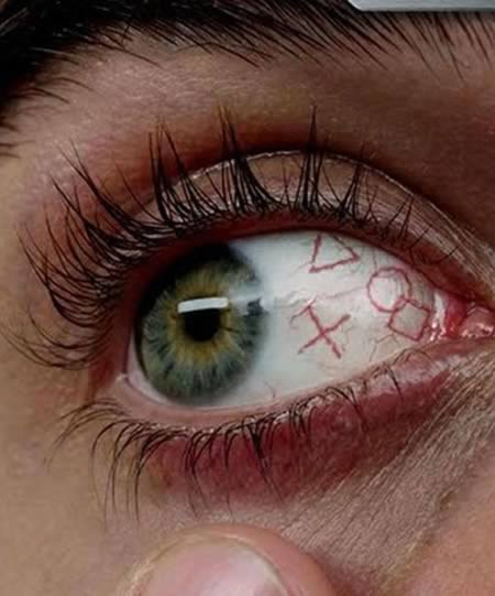 Xăm nhãn cầu, một trong những xu hướng làm đẹp quái dị và đau đớn.