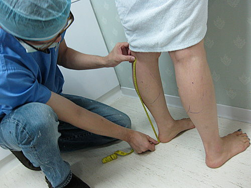 Có 2 cách để làm thu nhỏ bắp chân. Cách 1: cắt thần kinh chọn lọc: chỉ cắt nhánh thần kinh chỉ huy hoạt động của bó trong cơ sinh đôi. Sau khi cắt bó cơ trong của cơ sinh đôi sẽ teo đi. Một số phẫu thuật viên còn cắt cả thần kinh của bó ngoài cơ sinh đôi. Ưu điểm của phương pháp nầy là nhanh, ít xâm lấn, hồi phục nhanh.