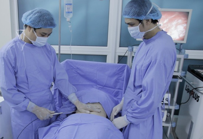 Khách hàng sẽ nằm viện 1 ngày, ngay sau phẫu thuật có thể vận động đi bộ bình thường. Thông thường sau 2 tuần cơ bắp chân bắt đầu teo nhỏ, kết quả bắp chân trở nên thon gọn rõ rệt sau 2-3 tháng với chu vi bắp chân giảm 2-4 cm.