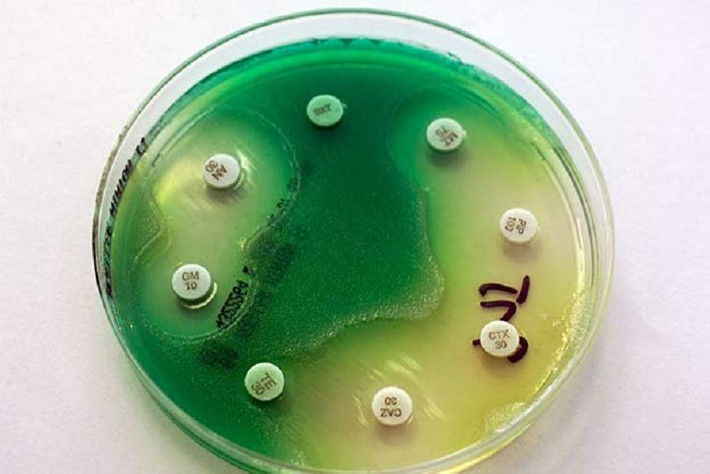Với “sức chịu đựng” khá dẻo dai, Pseudomonas aeruginosa – loại vi khuẩn gây các hiện tượng nhiễm trùng - có thể sinh sống khắp nơi, thậm chí là cả bề mặt chiếc điện thoại của bạn.