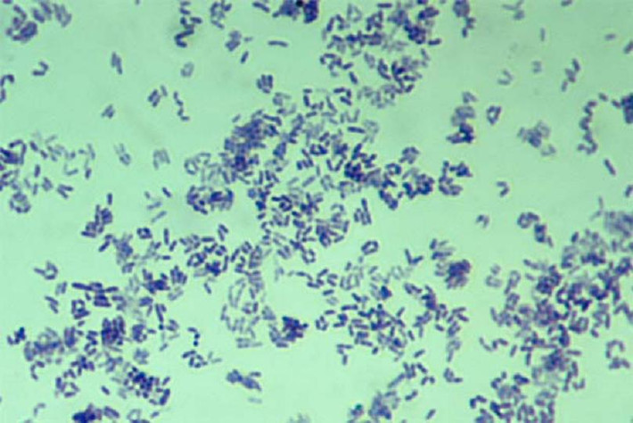 Năm nay, các nhà nghiên cứu của Đại học Oregon đã tìm thấy Corynebacterium trên một số màn hình điện thoại. May mắn là đây không phải chủng gây bệnh bạch hầu.