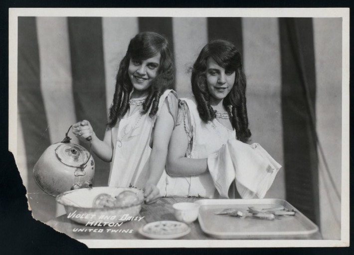 Daisy và Violet sinh ra vào năm 1908 tại Bringhton, nước Anh bởi cô bồi bàn Kate Skinner. Họ sống từ năm 1908 cho đến năm 1969. Sinh ra với phần dính liền xương chậu và hông, cặp song sinh này đã kiếm được bội tiền nhờ tài năng biểu diễn clarinet, saxophone, hát và nhảy múa. Đến năm 1969, cặp song sinh này đã qua đời do bị cúm.