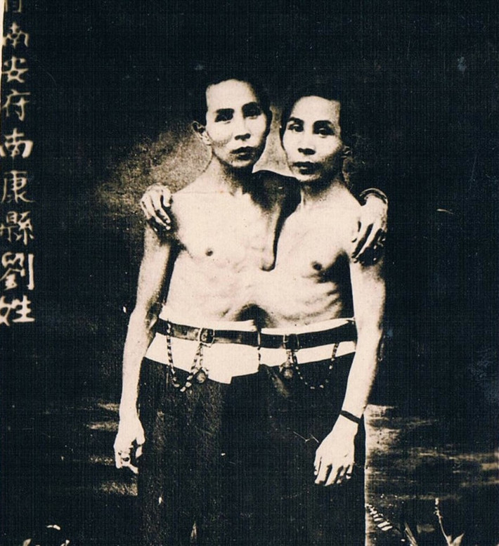 Liou Seng-Sen và Liou Tang-Sen (71 tuổi). Cặp song sinh dính liền người này được sinh ra năm 1866 ở Trung Quốc, mẹ của họ đã qua đời ngay sau khi sinh, họ lớn lên bởi bàn tay chăm sóc của người cha. Đến năm 1957, sức khỏe họ nhanh chóng xuống cấp và qua đời bởi căn bệnh viêm phế quản cấp.