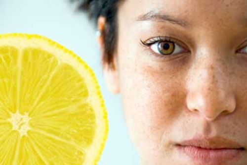 Chanh hoặc cam. Axit citric trong chanh hoặc cam đều có tác dụng làm sáng da, đặc biệt thích hợp để trị nám. Để tăng hiệu quả của mặt nạ này, bạn có thể trộn thêm sữa chua để đắp mặt trong 15 phút.