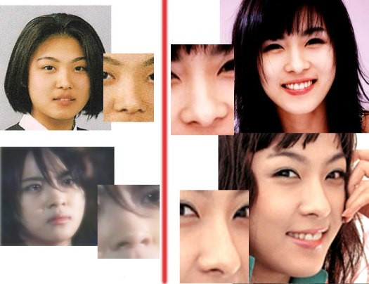Sự biến đổi vượt bậc trên khuôn mặt Ha Ji Won có lẽ sẽ khiến nhiều người ngỡ ngàng bởi 2 khuôn hình quá khác nhau. Chiếc cằm thon gọn và dài hơn, cộng với đôi mắt to tròn đã góp phần không nhỏ trong sự nghiệp đình đám của cô thời điểm hiện tại.